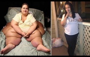 La increíble transformación de una mujer que perdió 400  kilos
